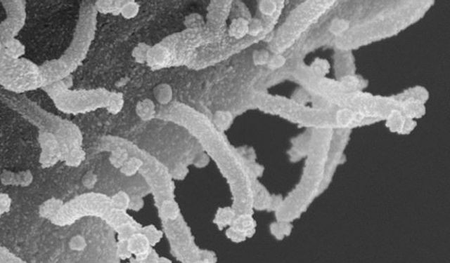 Bilim insanları, Korona virüs Covid-19'u ilk kez böyle görüntüledi,, hücrelere böyle bulaşıyormuş