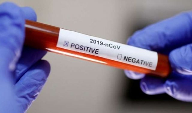 ABD Başkanı Trump'tan Kodonavirüs (Covid-19) aşısı için iddialı açıklama, tarih verdi, seçimi işaret etti