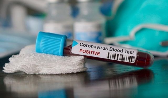 Bir haftada 485 çocuk daha koronavirüsten hasta oldu
